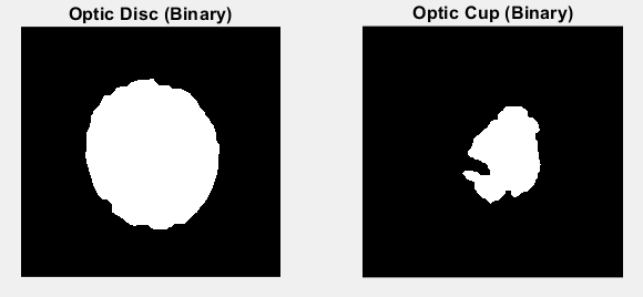 The optic disc and optic cup as binary masks